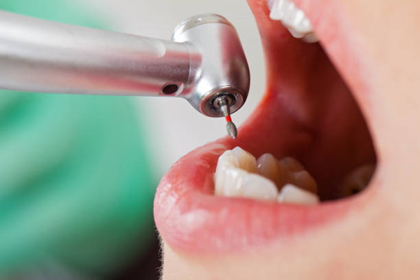 Best Emergency Broken Tooth Repair in Ford City, CA